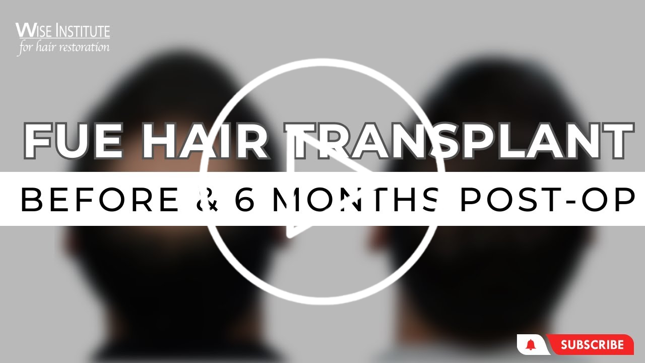 maxresdefault-play-fue-hair