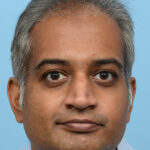 Fue Before and After | Dr. Jeffrey Wise