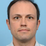 Fue Before and After | Dr. Jeffrey Wise