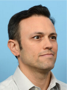 Fue Before and After | Dr. Jeffrey Wise