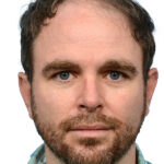 Fue Before and After | Dr. Jeffrey Wise