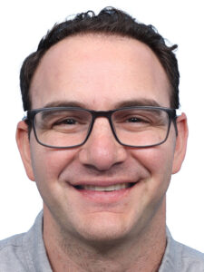 Fue Before and After | Dr. Jeffrey Wise