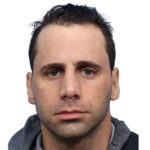Fue Before and After | Dr. Jeffrey Wise