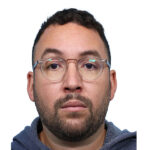 Fue Before and After | Dr. Jeffrey Wise