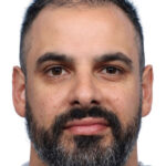 Fue Before and After | Dr. Jeffrey Wise