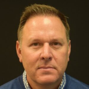 Fue Before and After | Dr. Jeffrey Wise