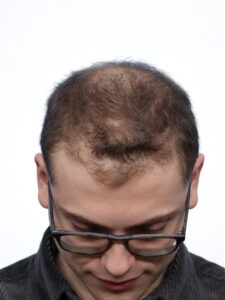 Fue Patient 265 Before