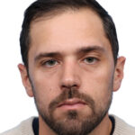 Fue Before and After | Dr. Jeffrey Wise