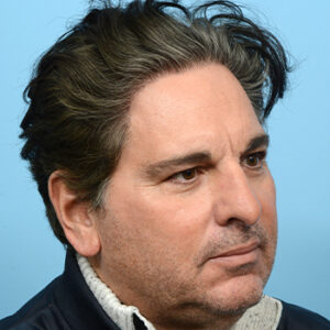 Fue Before and After | Dr. Jeffrey Wise