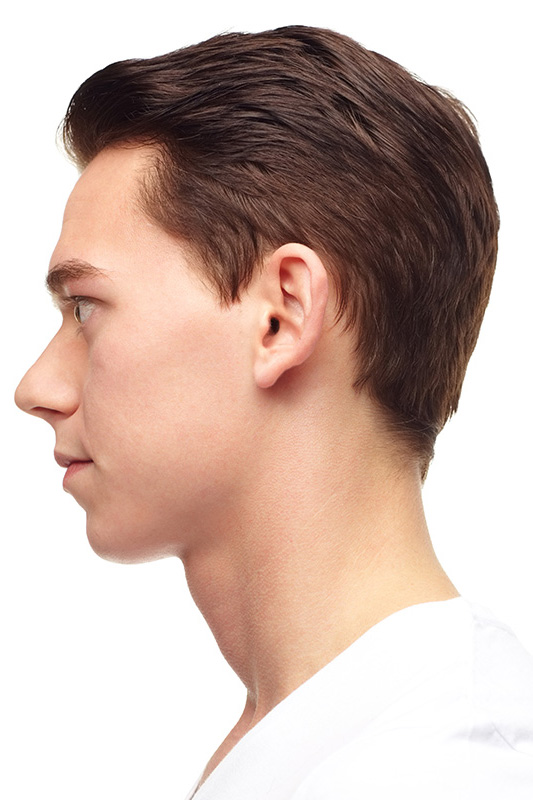Left Photo Example