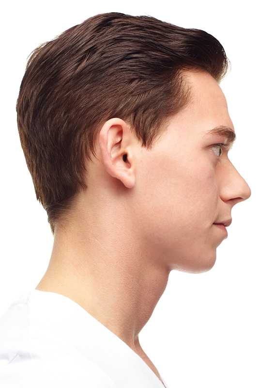Right Photo Example